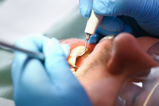 Best Emergency Dentist for Knocked-Out Tooth in Clearlake Riviera, CA