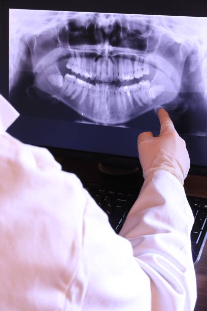 Best Emergency Dentist for Lost Fillings or Crowns in Clearlake Riviera, CA