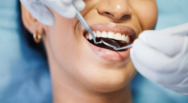 Best Emergency Dental Care for Abscessed Tooth in Clearlake Riviera, CA