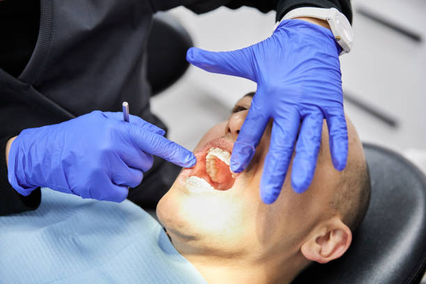 Best Emergency Dentist for Lost Fillings or Crowns in Clearlake Riviera, CA